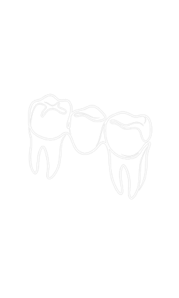 Dental Bridge